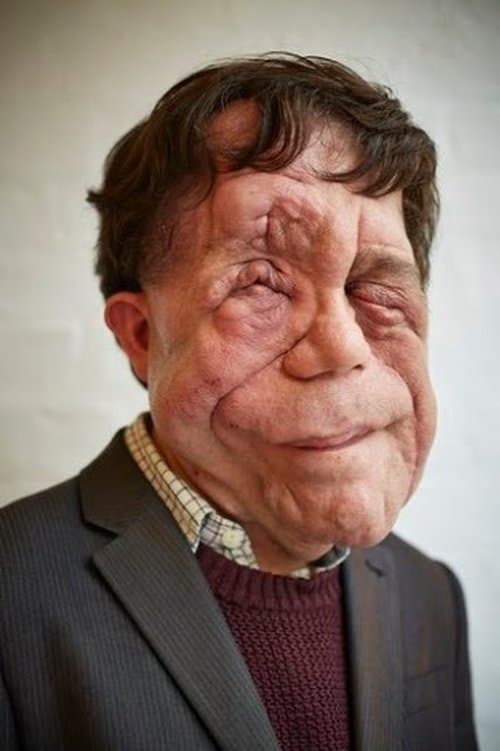 Zdjęcie Adam Pearson